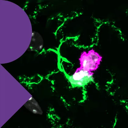 Neuroimmunology